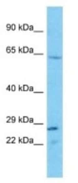TAS2R43 Rabbit anti-Human, Polyclonal, Novus Biologicals:Antibodies:Primary